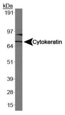 Invitrogen Cytokeratin 1 Monoclonal Antibody (LHK1) 100 &mu;L | Buy Online | Invitrogen&trade; | Fisher Scientific