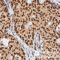 TERT Monoclonal Antibody (2D8):Antibodies, Monoclonal