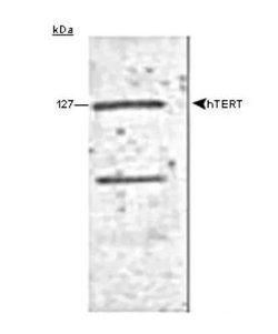 TERT Monoclonal Antibody (2D8):Antibodies, Monoclonal