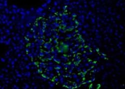 Invitrogen HPa1 Monoclonal Antibody (DHIC2-2C12) 100 &mu;L | Buy Online | Invitrogen&trade; | Fisher Scientific
