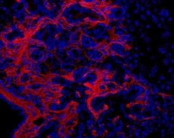 Invitrogen Oval Cell Marker Monoclonal Antibody (OC2-1C6) 100 &mu;L | Buy Online | Invitrogen&trade; | Fisher Scientific
