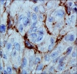 Invitrogen PHD3 Monoclonal Antibody (EG188e/d5) 200 &mu;L; Unconjugated:Antibodies,