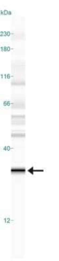 Invitrogen PHD3 Monoclonal Antibody (EG188e/d5) 200 &mu;L; Unconjugated:Antibodies,