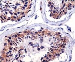 TFAM Monoclonal Antibody (18G102B2E11):Antibodies, Monoclonal