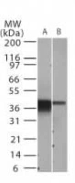 Invitrogen IkB alpha Monoclonal Antibody (6A920) 100 &mu;g; Unconjugated:Antibodies,