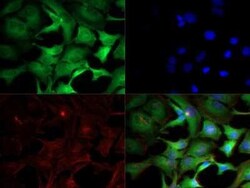 Invitrogen&trade;&nbsp;IKK alpha Monoclonal Antibody (14A231)