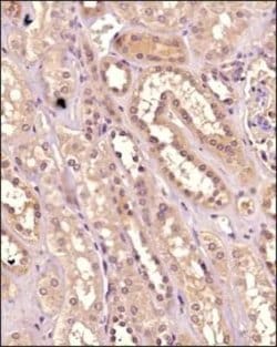 Invitrogen IKK alpha Monoclonal Antibody (14A231) 100 &mu;g; Unconjugated:Antibodies,