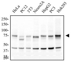 Invitrogen IKK alpha Monoclonal Antibody (14A231) 100 &mu;g; Unconjugated:Antibodies,