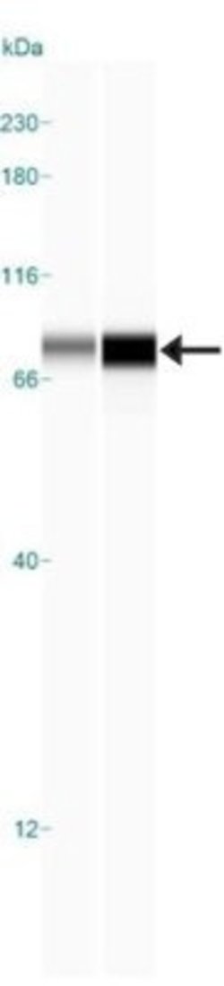 Invitrogen IKK alpha Monoclonal Antibody (14A231) 100 &mu;g; Unconjugated:Antibodies,