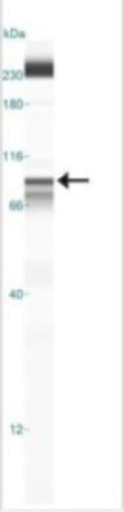Invitrogen IKK beta Monoclonal Antibody (10A9B6) 100 &mu;g; Unconjugated:Antibodies,