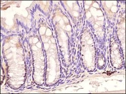 Invitrogen TLR3 Monoclonal Antibody (40C1285.6) 100 &mu;g; Unconjugated:Antibodies,