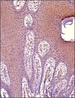 Invitrogen MiTF Monoclonal Antibody (21D1418) 100 &mu;g; Unconjugated:Antibodies,