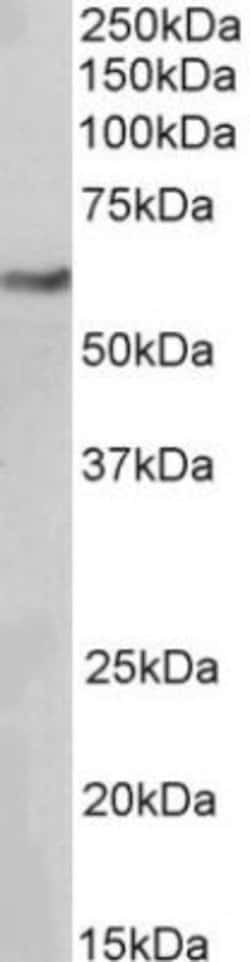 Invitrogen MiTF Monoclonal Antibody (21D1418) 100 &mu;g; Unconjugated:Antibodies,