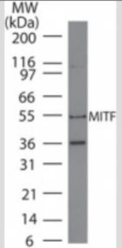 Invitrogen MiTF Monoclonal Antibody (21D1418) 100 &mu;g; Unconjugated:Antibodies,