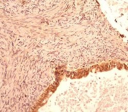 Invitrogen Caspase 1 Monoclonal Antibody (14F468) 100 &mu;g; Unconjugated:Antibodies,