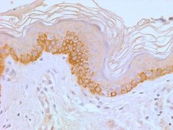 Invitrogen TLR4 Monoclonal Antibody (76B357.1) 100 &mu;g; Unconjugated:Antibodies,
