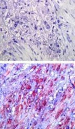 Invitrogen TLR4 Monoclonal Antibody (76B357.1) 100 &mu;g; Unconjugated:Antibodies,