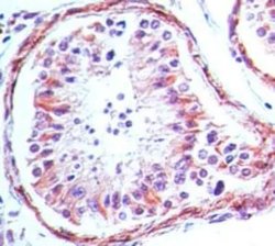 Invitrogen TLR4 Monoclonal Antibody (76B357.1) 100 &mu;g; Unconjugated:Antibodies,