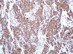 Invitrogen HMGB1 Monoclonal Antibody (19N15F4) 100 &mu;g; Unconjugated:Antibodies,