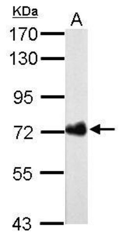 Invitrogen Helicobacter pylori Urease B Monoclonal Antibody (GT962) 100