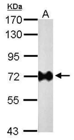 Invitrogen Helicobacter pylori Urease B Monoclonal Antibody (GT1263) 100