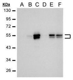 Invitrogen Carbonic Anhydrase IX Monoclonal Antibody (GT12) 100 &mu;L;