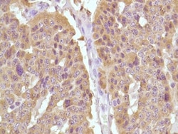 Invitrogen Calcitonin Monoclonal Antibody (SP17) 500 &mu;L; Unconjugated:Antibodies,