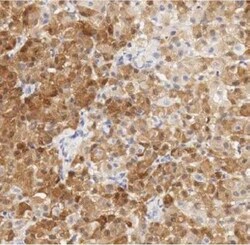 Invitrogen Calretinin Monoclonal Antibody (SP13):Antibodies:Primary Antibodies