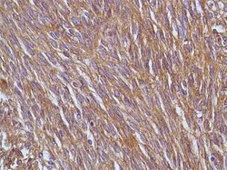 Invitrogen DOG-1 Recombinant Rabbit Monoclonal Antibody (SP31) 500 &mu;L;