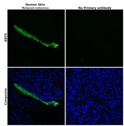 Invitrogen Cytokeratin 5 Monoclonal Antibody (SP27) 500 &mu;L; Unconjugated:Antibodies,
