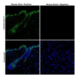 Invitrogen Cytokeratin 5 Monoclonal Antibody (SP27) 500 &mu;L; Unconjugated:Antibodies,