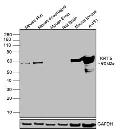 Invitrogen Cytokeratin 5 Monoclonal Antibody (SP27) 500 &mu;L; Unconjugated:Antibodies,