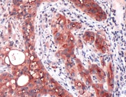 Invitrogen Mesothelin Monoclonal Antibody (SP74) 500 &mu;L; Unconjugated:Antibodies,