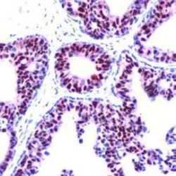 Invitrogen Progesterone Receptor Monoclonal Antibody (SP42) 500 &mu;L;