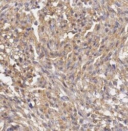 Invitrogen Vimentin Monoclonal Antibody (SP20) 500 &mu;L; Unconjugated:Antibodies,