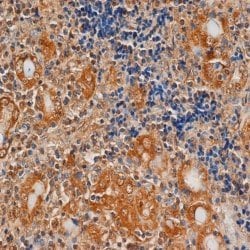 Invitrogen TSH Receptor Monoclonal Antibody (4C1) 200 &mu;g | Buy Online | Invitrogen&trade; | Fisher Scientific