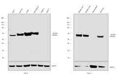 Invitrogen ALDH2 Monoclonal Antibody (4G6A3) 100 &mu;g; Unconjugated:Antibodies,