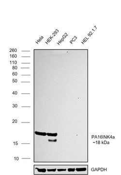 Invitrogen p16INK4a Monoclonal Antibody (1D7D2) 100 &mu;L; Unconjugated:Antibodies,