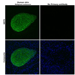 Invitrogen Cytokeratin 5 Monoclonal Antibody (2C2) 100 &mu;g; Unconjugated:Antibodies,