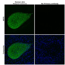 Invitrogen Cytokeratin 5 Monoclonal Antibody (2C2) 100 &mu;g; Unconjugated:Antibodies,