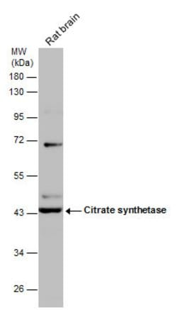 Invitrogen Citrate Synthase Monoclonal Antibody (GT2061) 100 &mu;L; Unconjugated:Antibodies,