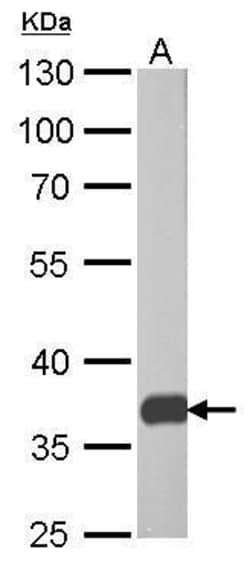 Invitrogen PEX19 Monoclonal Antibody (GT554) 100 &mu;L; Unconjugated:Antibodies,