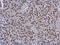 Invitrogen HNF1A Monoclonal Antibody (GT4110) 100 &mu;L; Unconjugated:Antibodies,
