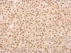 Invitrogen IP6K1 Monoclonal Antibody (GT10611) 100 &mu;L; Unconjugated:Antibodies,