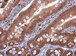 Invitrogen IDH2 Monoclonal Antibody (GT673) 100 &mu;L | Buy Online | Invitrogen&trade; | Fisher Scientific