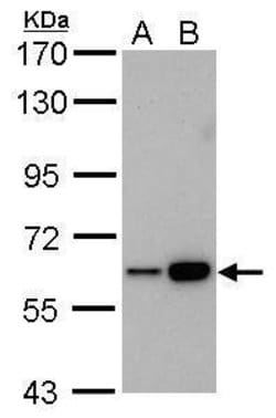 Invitrogen CBS Monoclonal Antibody (GT519) 100 &mu;L; Unconjugated:Antibodies,