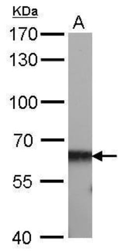 Invitrogen CBS Monoclonal Antibody (GT519) 100 &mu;L; Unconjugated:Antibodies,