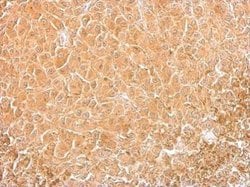 Invitrogen Cofilin Monoclonal Antibody (GT567) 100 &mu;L; Unconjugated:Antibodies,