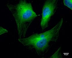 Invitrogen Cofilin Monoclonal Antibody (GT567) 100 &mu;L; Unconjugated:Antibodies,