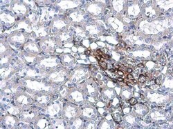 Invitrogen TAGLN Monoclonal Antibody (GT336) 100 &mu;L; Unconjugated:Antibodies,